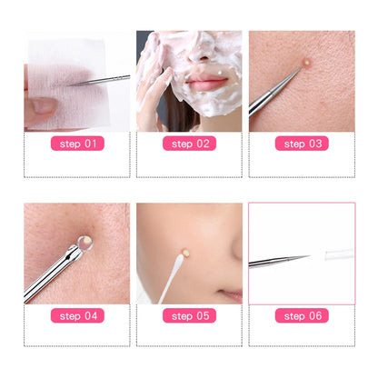 1 Pcs Blackhead Comedone Acne Pimple Blemish Extractor Remover Stainless Steel Needles Remove Tools Face Skin Care Pore Cleaner