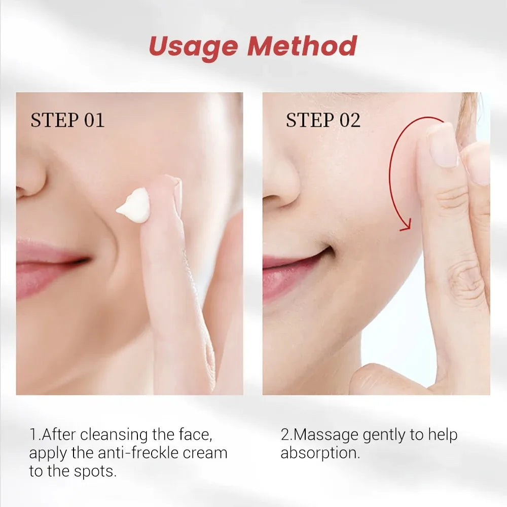 20g Whitening Freckle Cream Remove Dark Spot Cream Anti Freckle and Aging Cream Fade Pigmentation Melasma Brighten Serum Skin