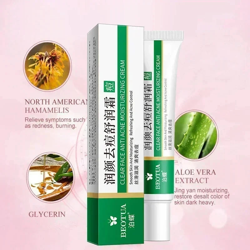 Herbal Acne Treatment Cream Face Scar Blackhead Remover Repair Gel Oil Control Shrink Pores Whitening Skin Care Korean Cosmetics