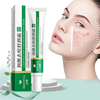 Herbal Acne Treatment Cream Face Scar Blackhead Remover Repair Gel Oil Control Shrink Pores Whitening Skin Care Korean Cosmetics