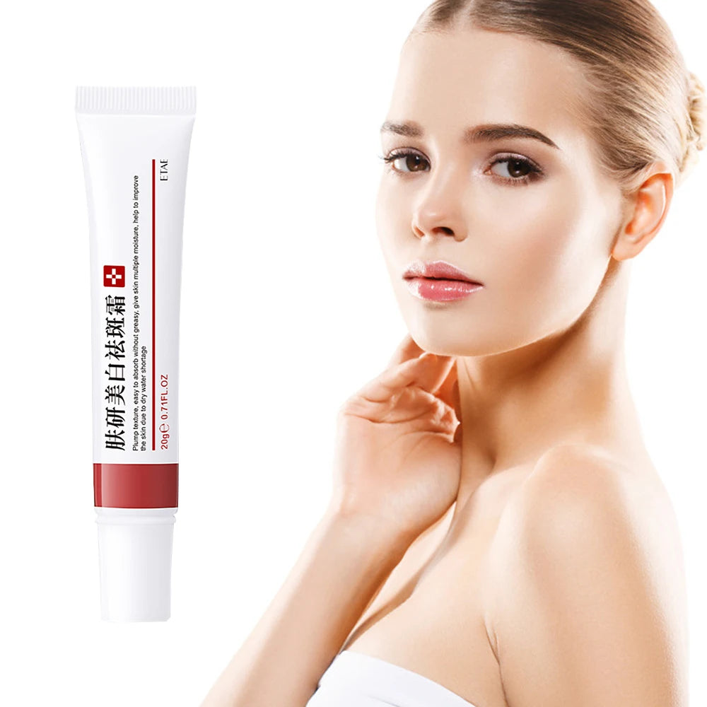 20g Whitening Freckle Cream Remove Dark Spot Cream Anti Freckle and Aging Cream Fade Pigmentation Melasma Brighten Serum Skin