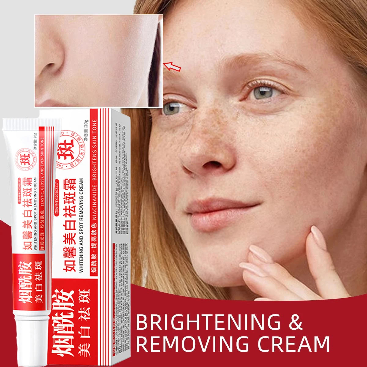 Whitening Cream Anti Freckle Face Cream, Remove The Black ，Melasma Dark Spot Acne Deposits On The Skin，Brightening Skin Care