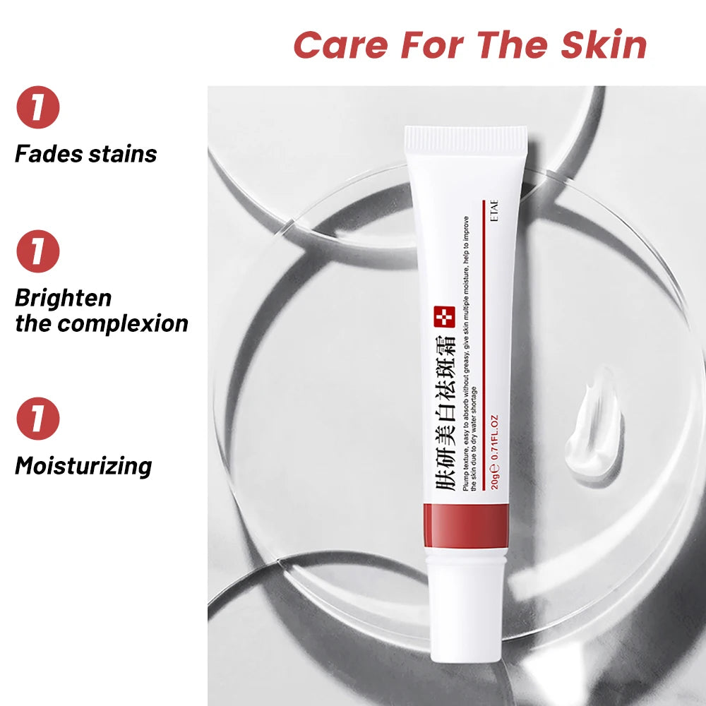 20g Whitening Freckle Cream Remove Dark Spot Cream Anti Freckle and Aging Cream Fade Pigmentation Melasma Brighten Serum Skin